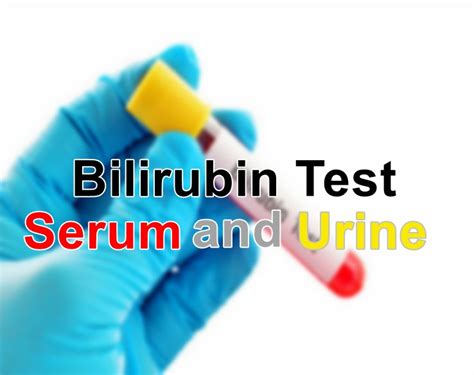 Bilirubin in Urine: MedlinePlus Medical Test